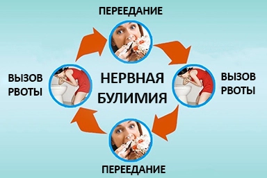 Лечение булимии в Вешенской